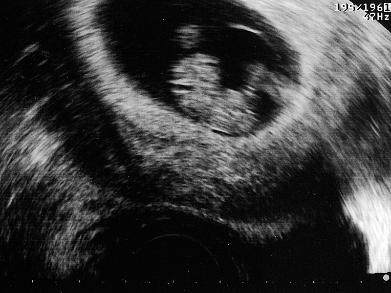 8-Week-Old Baby