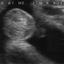 Max's "Boy Shot" at 33 Weeks & 2 Days