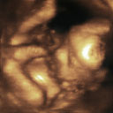 3D Ultrasound of Max at 30 Weeks