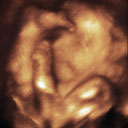 3D Ultrasound of Max at 30 Weeks